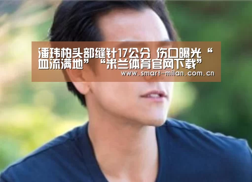潘玮柏头部缝针17公分 伤口曝光“血流满地”“米兰体育官网下载”(图2) 米兰平台